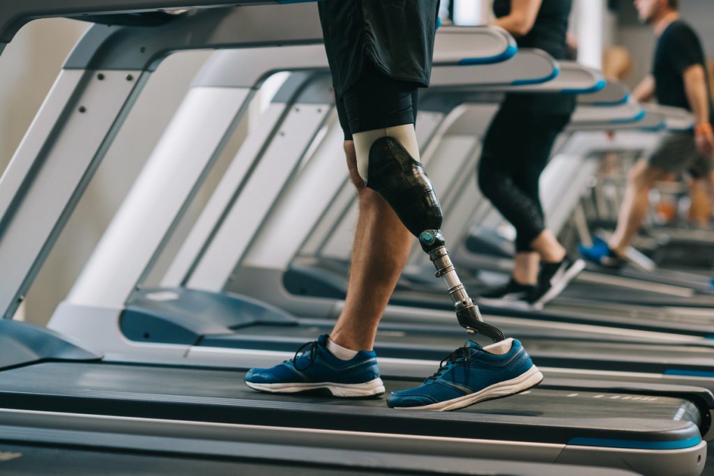 Man with prosthetic leg on treadmill